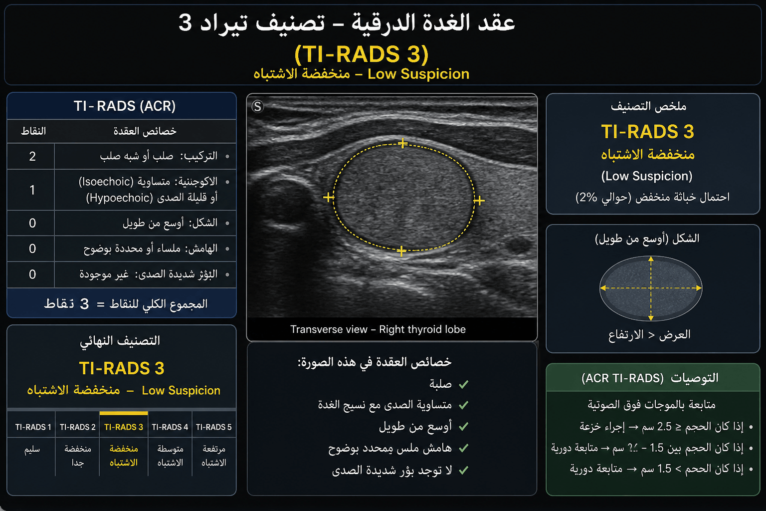 عقد الغدة الدرقية تيراد 3